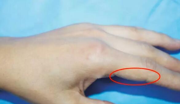 水银体温计将被禁止生产，别再给孩子用了