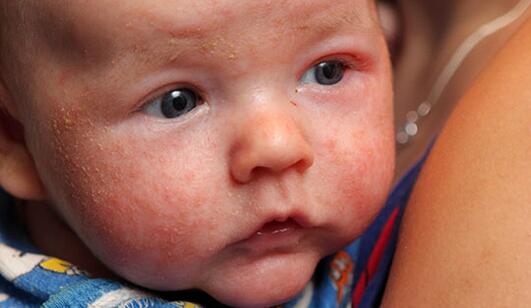 妈妈必读的宝宝最常见疾病及护理方法