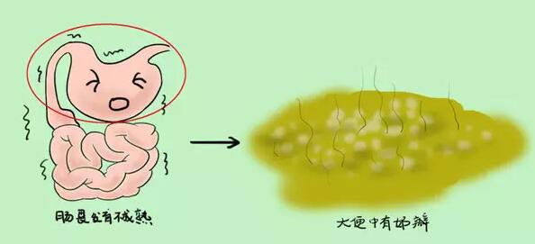 从婴儿大便，来看宝宝健康问题