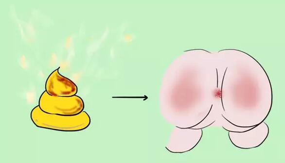 从婴儿大便，来看宝宝健康问题