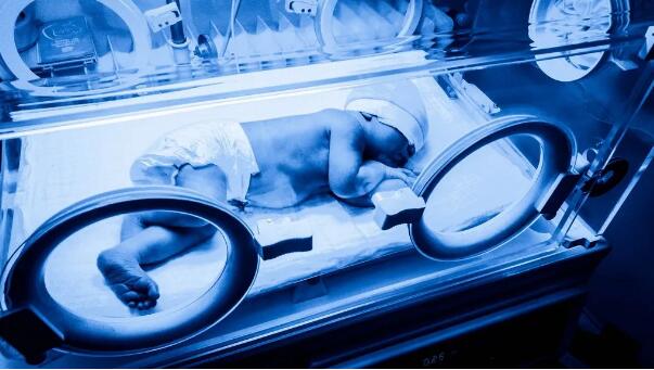 新生儿黄疸很常见，那需要医学干预吗？