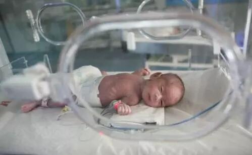 关注早产宝宝智力发育，预防脑瘫和智力低下