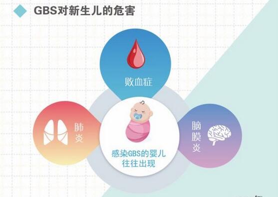产检新增gbs检查，筛查阳性该怎么办？