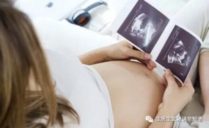 生男生女早知道 孕囊大小看男女