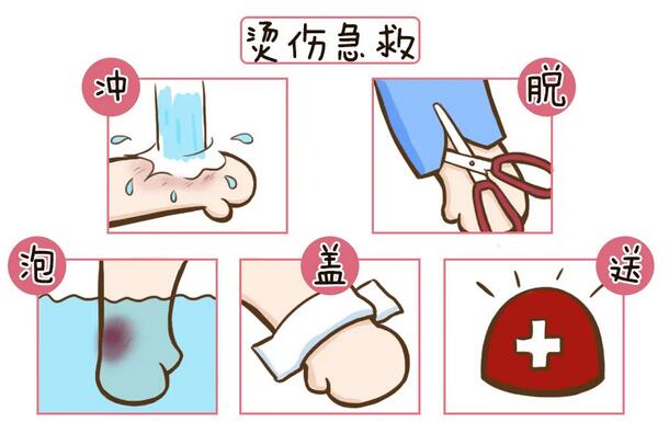 烫伤后怎么处理