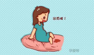 孕早期阴道出血，可能是这4种原因引起的