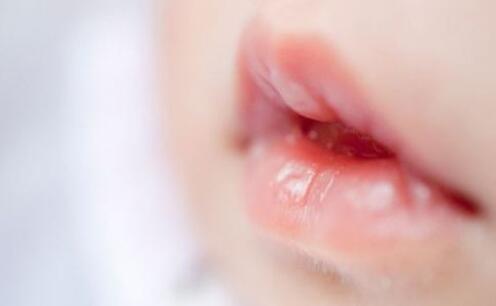 秋冬季宝宝嘴唇干裂怎么办？试试这些方法吧