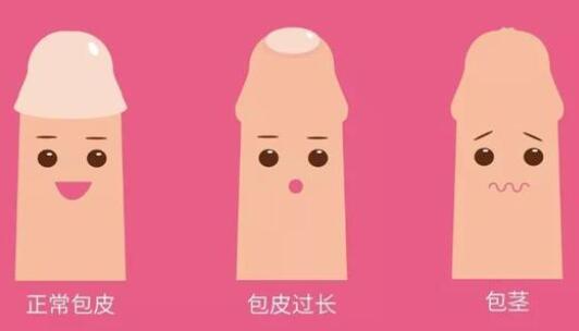 割包好处和坏处