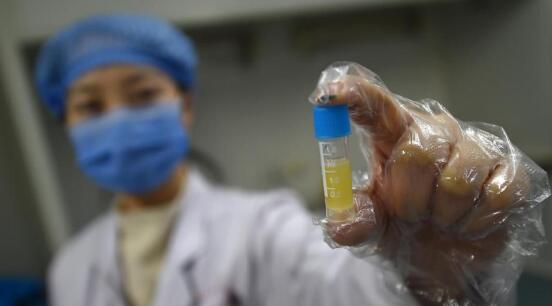 男人是怎么捐献精子的