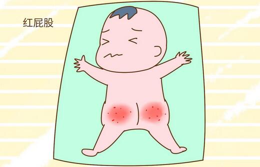 宝宝红屁屁什么原因？红屁股怎么办？