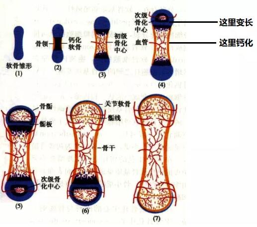 维生素d中毒症有啥表现？补多了是否就不长个了？