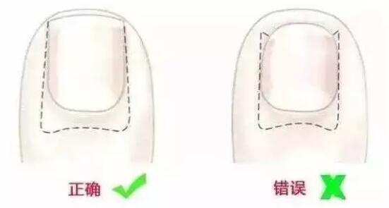 给宝宝剪指甲该怎么剪