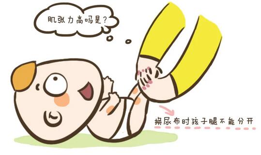 肌张力高的常见误区有哪些