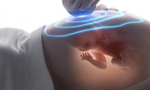 双顶径股骨长可以看男女，真的吗？