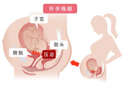 孕期憋尿是大忌，4招帮你减轻孕妇尿频