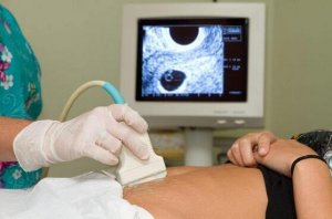 孕早期b超单怎么看？弄清这5个指标