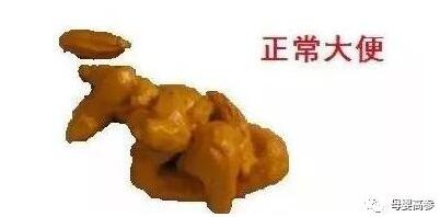 宝宝拉屎有奶瓣哪些需要警惕