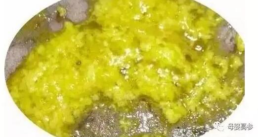 宝宝拉屎有奶瓣哪些需要警惕