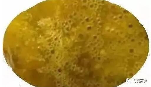 宝宝拉屎有奶瓣哪些需要警惕