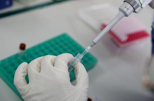 做核酸检测难受吗 核酸检测多久拿报告