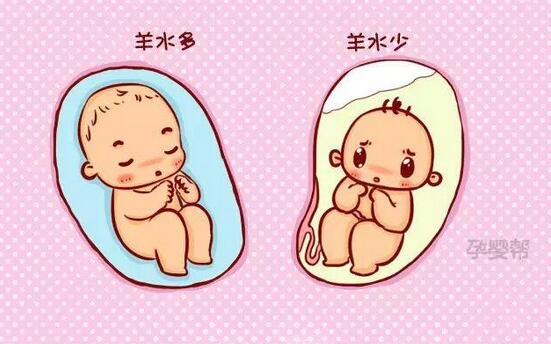孕妇羊水过少的原因和表现