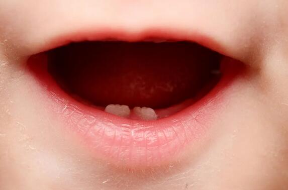 婴儿出牙期秘籍大放送，妈妈做好这些轻松应对