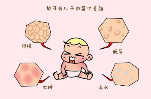 宝宝湿疹反反复复怎么办？教你7个小妙招