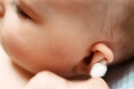 新生儿耳屎要不要掏