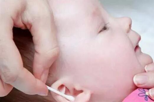 新生儿耳屎要不要掏