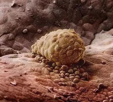 高清胎儿发育过程图