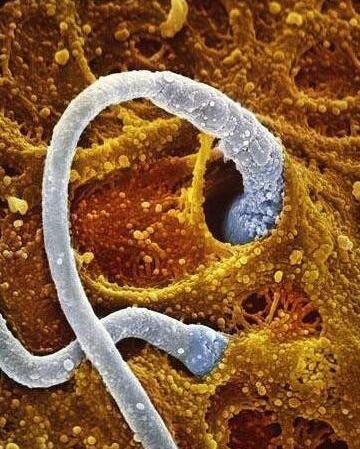 高清胎儿发育过程图