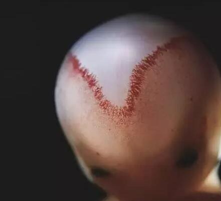 高清胎儿发育过程图