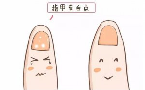 宝宝指甲上有白点是怎么回事