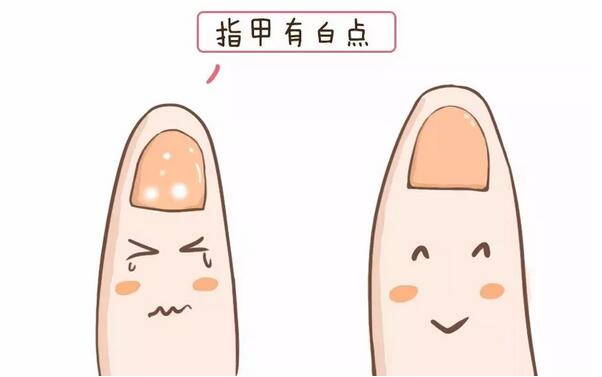 宝宝指甲上有白点是怎么回事