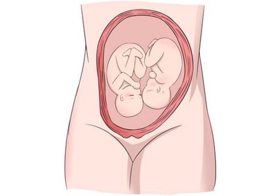 怀了双胞胎，准妈妈只能做剖宫产吗？