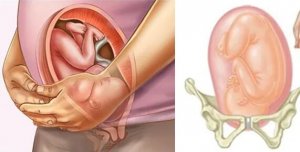 胎儿什么时候入盆？六个症状准备迎接宝宝
