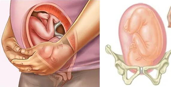 胎儿什么时候入盆？六个症状准备迎接宝宝