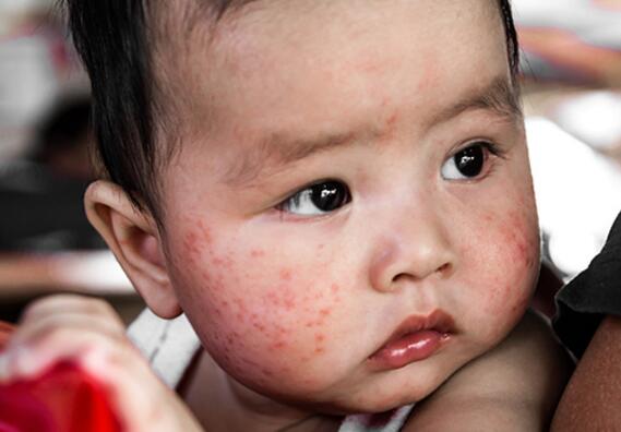 新生宝宝如何护理？家长要了解的7件事