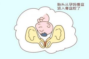 胎儿入盆是什么感觉