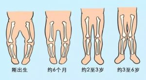 宝宝标准腿型长什么样？