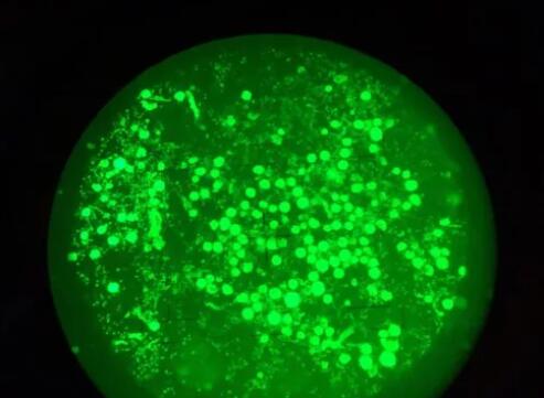 冻卵是什么意思？女性都应该了解一下