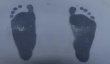 扁平足怎么判断 扁平足的危害