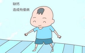 维生素D缺乏性佝偻病的症状