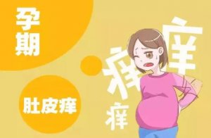 孕妇肚皮痒是怎么回事