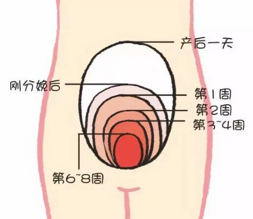 如何判断产后子宫恢复好不好