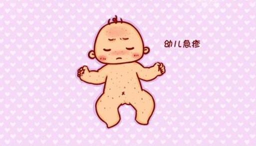 幼儿急疹注意事项