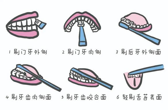 为什么天天刷牙，孩子牙齿还是很黄？