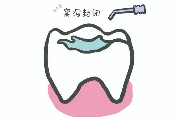 为什么天天刷牙，孩子牙齿还是很黄？