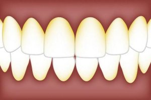 为什么天天刷牙，孩子牙齿还是很黄？