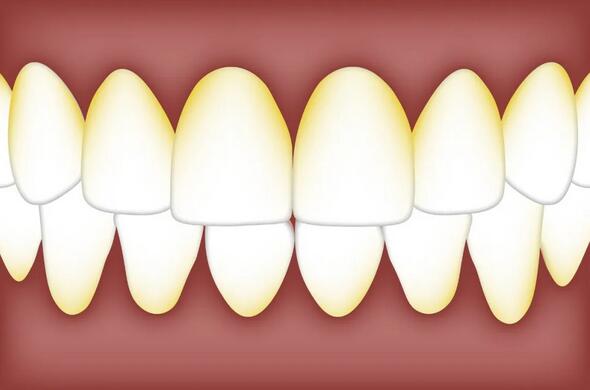 为什么天天刷牙，孩子牙齿还是很黄？